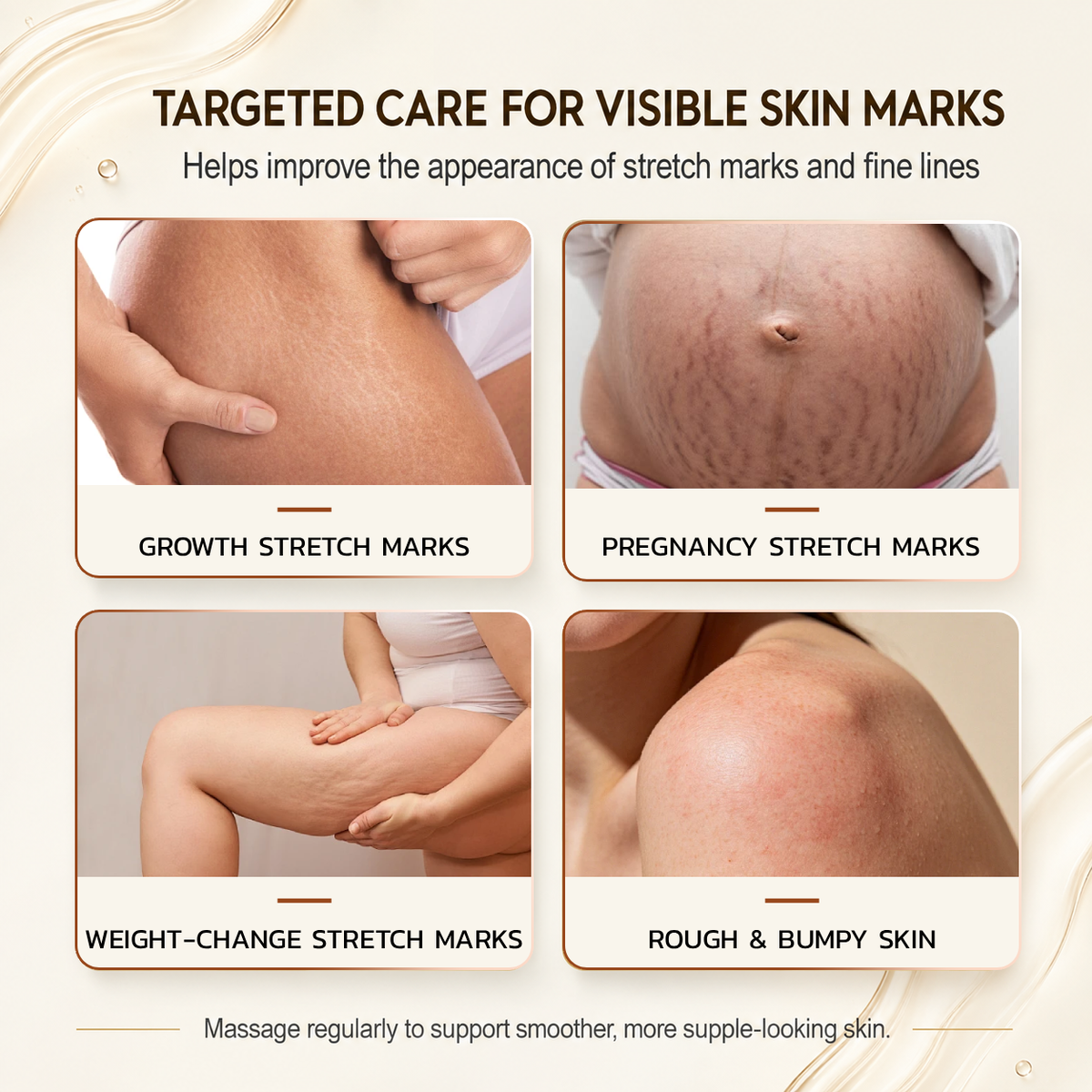 PORCOPE Dual-Phase Essence Oil for Stretch Marks, Pregnancy-Safe Body Lotion for Moms-to-Be and Women Trying to Conceive, Nourishing Body Care for Sensitive Skin