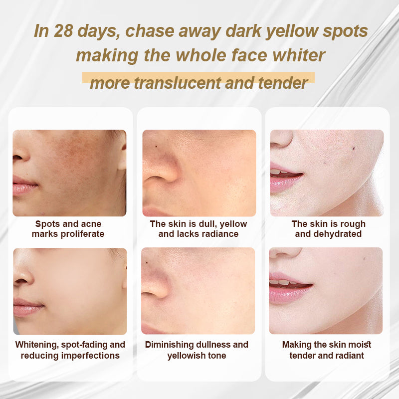 Porcope Aqua-Clear Whitening Toner 100ml 3.52OZ + Soothing Whitening Spot Lightening Lotion 100ml 3.52OZ,A set to improve uneven skin tonedark spots, and acne marks