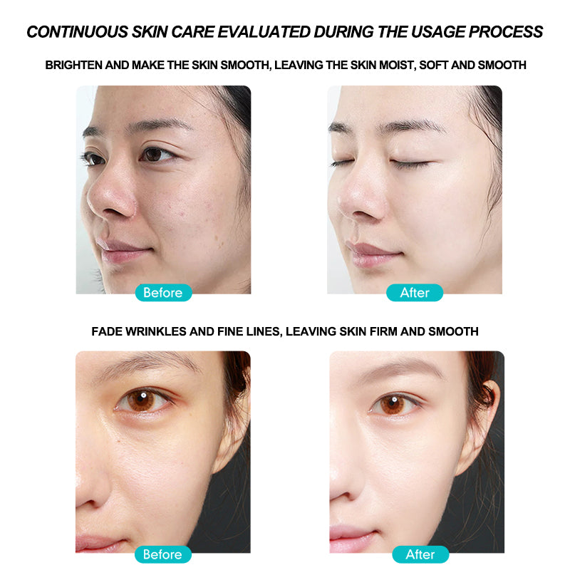 Porcope Intensive Carein One Night Making Youthful OUTHFUL Aan Radiant 5g*7particle