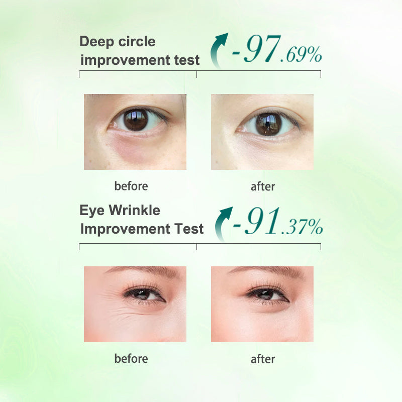 PORCOPE·Eye cream improves dark circles, wrinkles, nourishes eye bags, electric massage