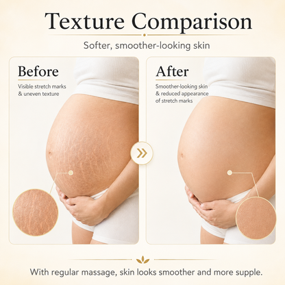 PORCOPE Dual-Phase Essence Oil for Stretch Marks, Pregnancy-Safe Body Lotion for Moms-to-Be and Women Trying to Conceive, Nourishing Body Care for Sensitive Skin