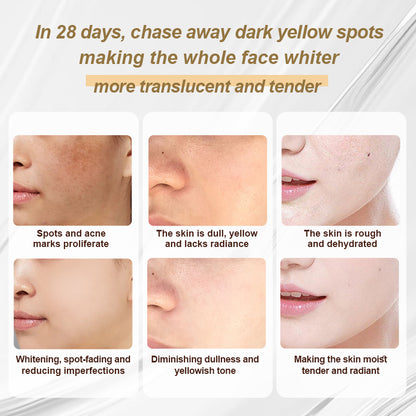 Porcope Aqua-Clear Whitening Toner 100ml 3.52OZ + Soothing Whitening  Spot Lightening Lotion 100ml 3.52OZ，A set to improve uneven skin tonedark spots, and acne marks