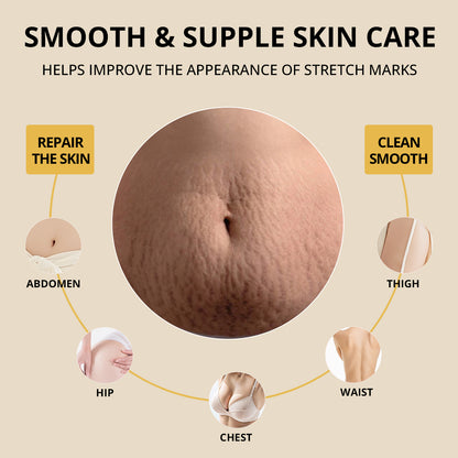 PORCOPE Dual-Phase Essence Oil for Stretch Marks, Pregnancy-Safe Body Lotion for Moms-to-Be and Women Trying to Conceive, Nourishing Body Care for Sensitive Skin