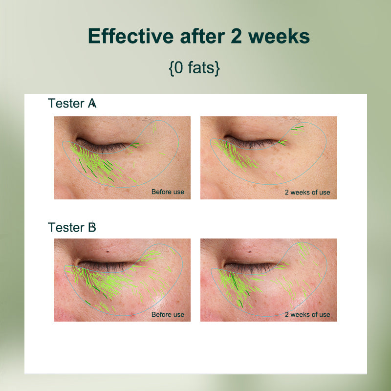 PORCOPE·Eye cream improves dark circles, wrinkles, nourishes eye bags, electric massage