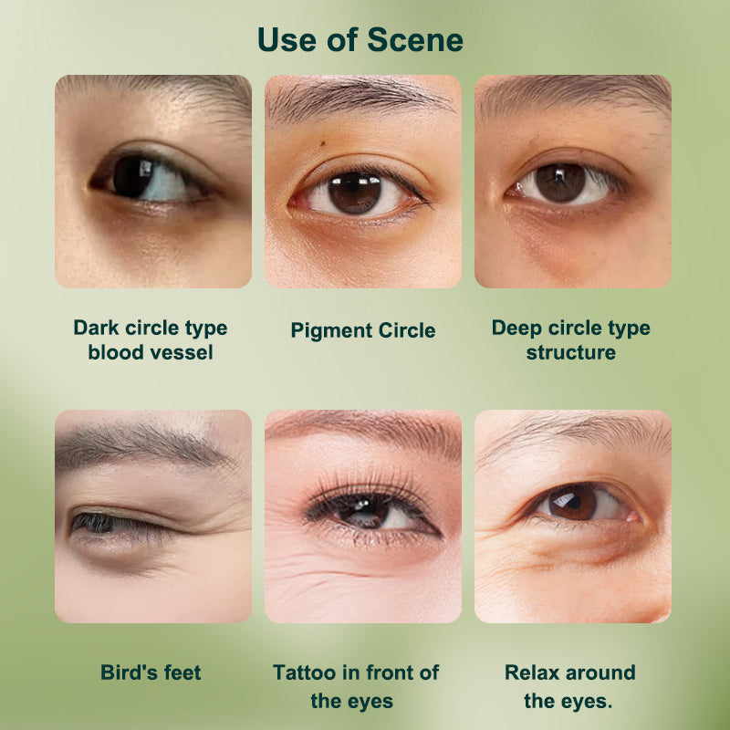 PORCOPE·Eye cream improves dark circles, wrinkles, nourishes eye bags, electric massage