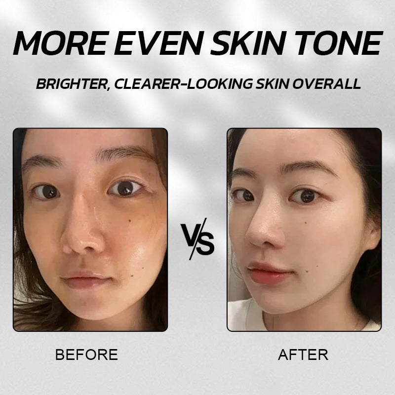 PORCOPE Whitening Skincare Set Cleanses Oil Control Cleanser Moisturizes Toner Brightening Serum